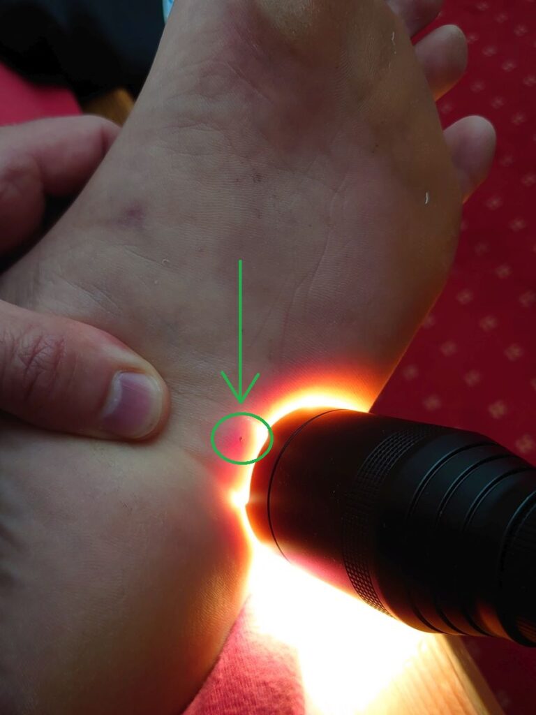 Fremdkörper finden mit Licht