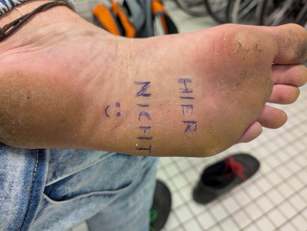 Kennzeichnung des falschen Fußes