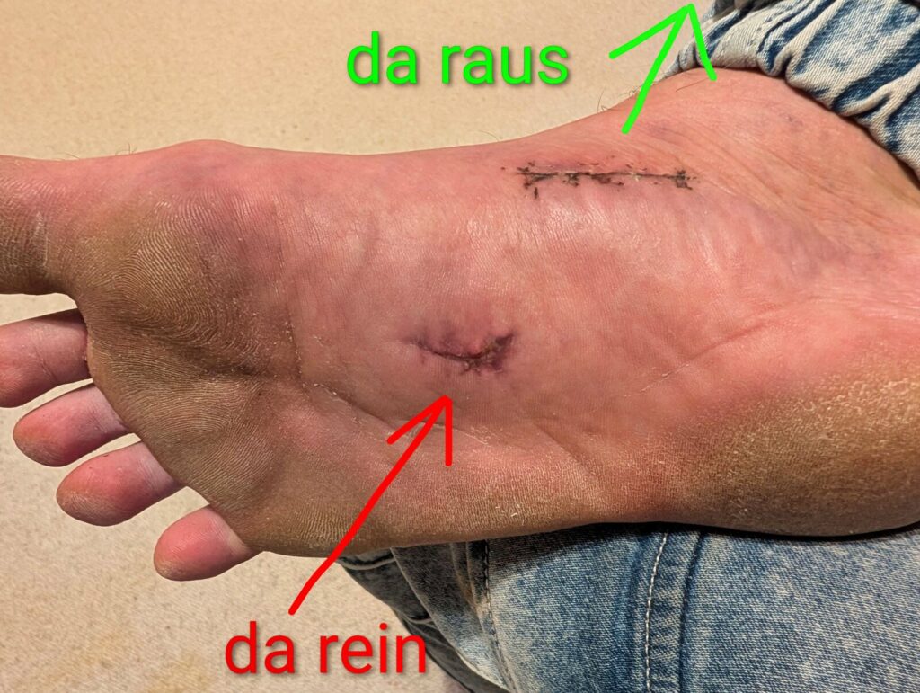 Rein-raus